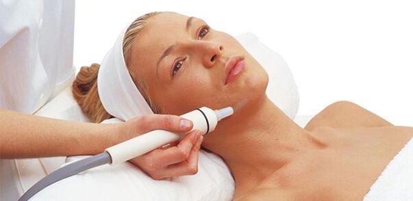 Facial peeling